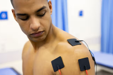 Electrical Stimulation